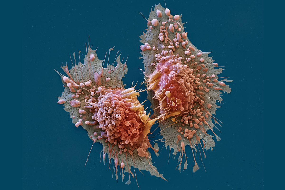 Канцерогенез раковые клетки