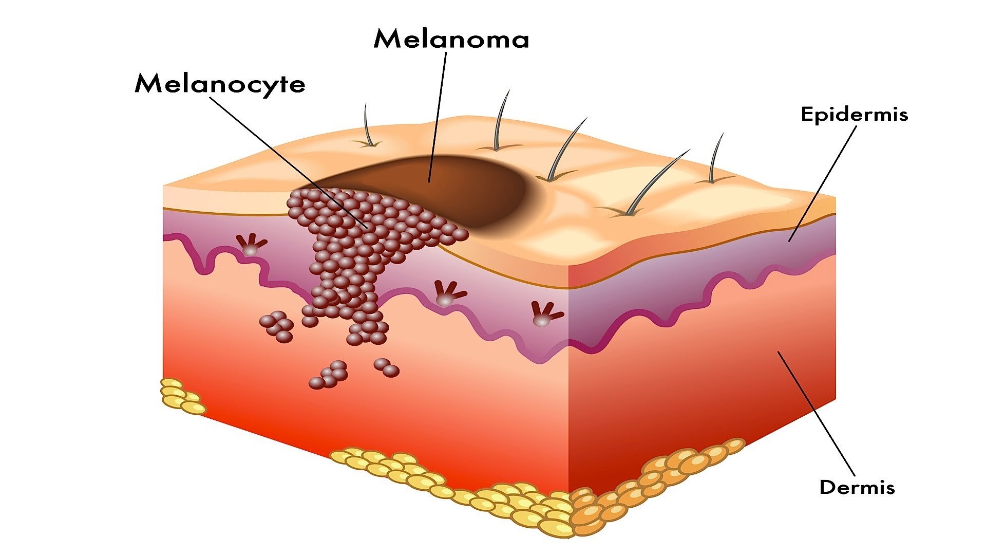 Folliculophilia