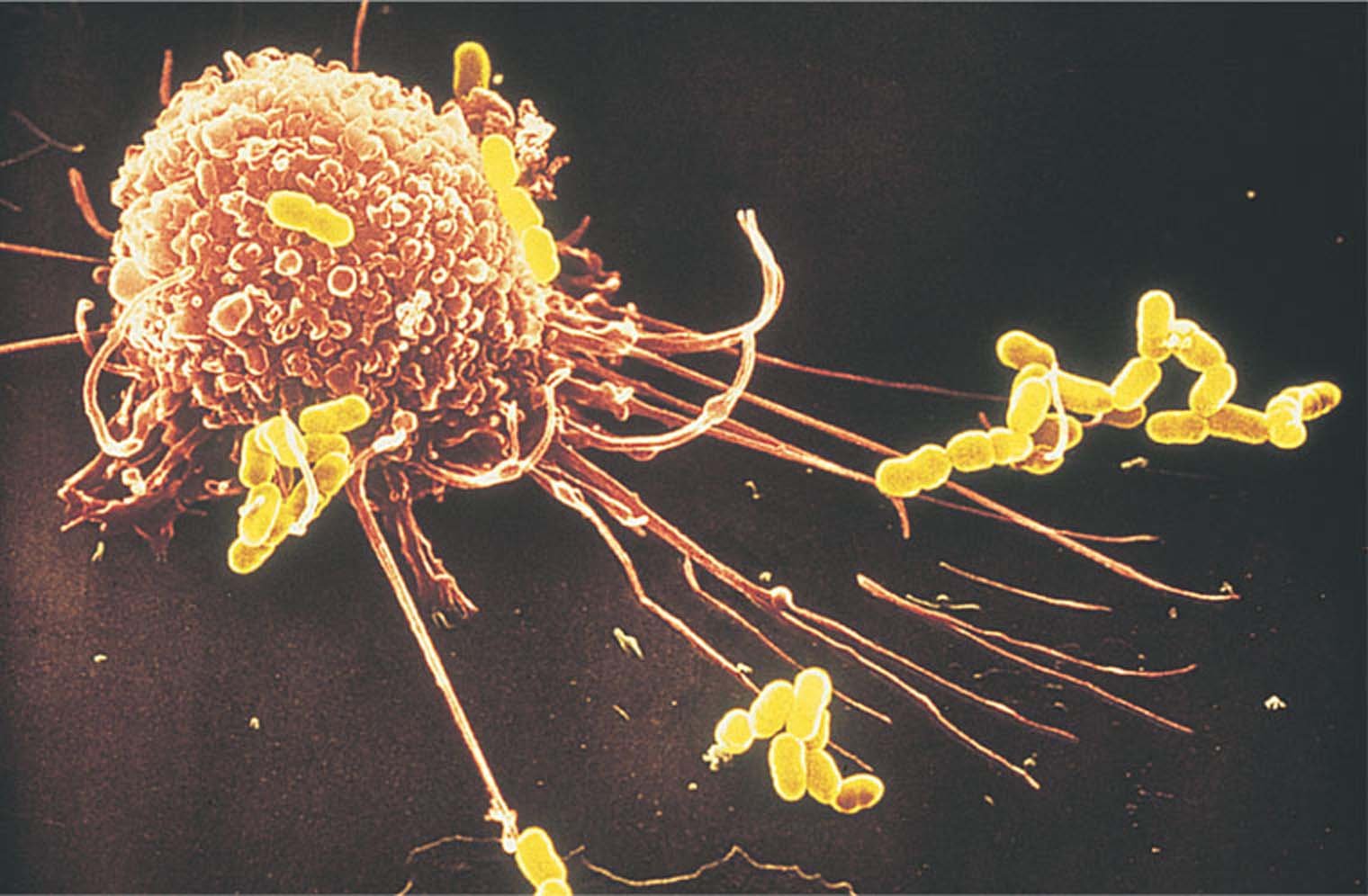 Макрофаги фагоцитоз. Фагоцитоз микрофаги и макрофаги. Лейкоциты пожирают бактерии. Фагоцит микрофотография. Лейкоциты и фагоциты.